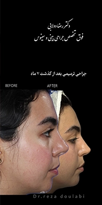 جراح ترمیمی بینی