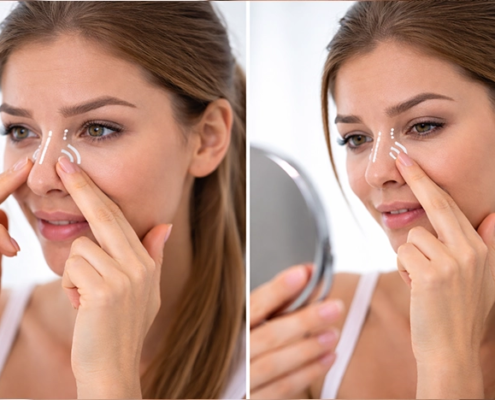 خط کانتور بعد از عمل بینی