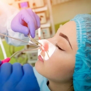 احتمال بازگشت پولیپها