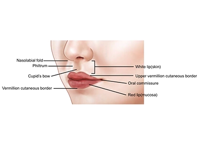 تقارن پره‌های بینی و بهبود زاویه بینی و لب بالا