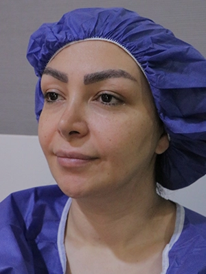 نتیجه جراحی ترمیمی بینی