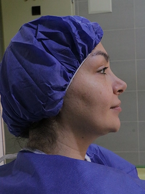 اصلاح بدشکلی بینی در جراحی ترمیمی