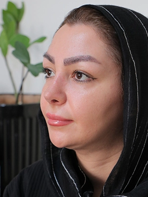 جراحی ترمیمی بینی - نمونه کار