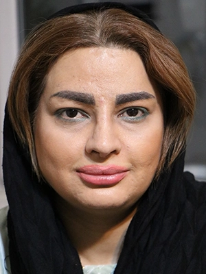 نتیجه جراحی ترمیمی بینی با غضروف