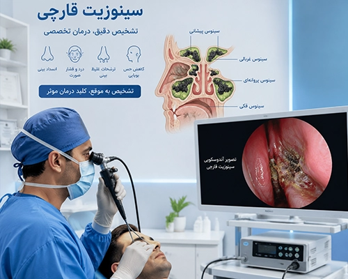 جراحی آندوسکوپی سینوس برای درمان سینوزیت قارچی و تومور بینی